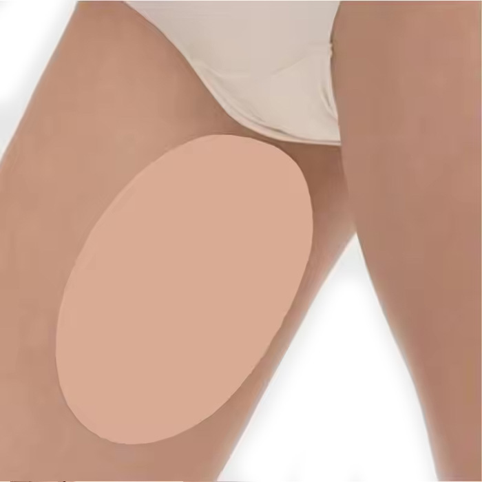AntiChafing, protezione autoadesiva per prevenire lo sfregamento tra le cosce (2 pezzi) - Image 3