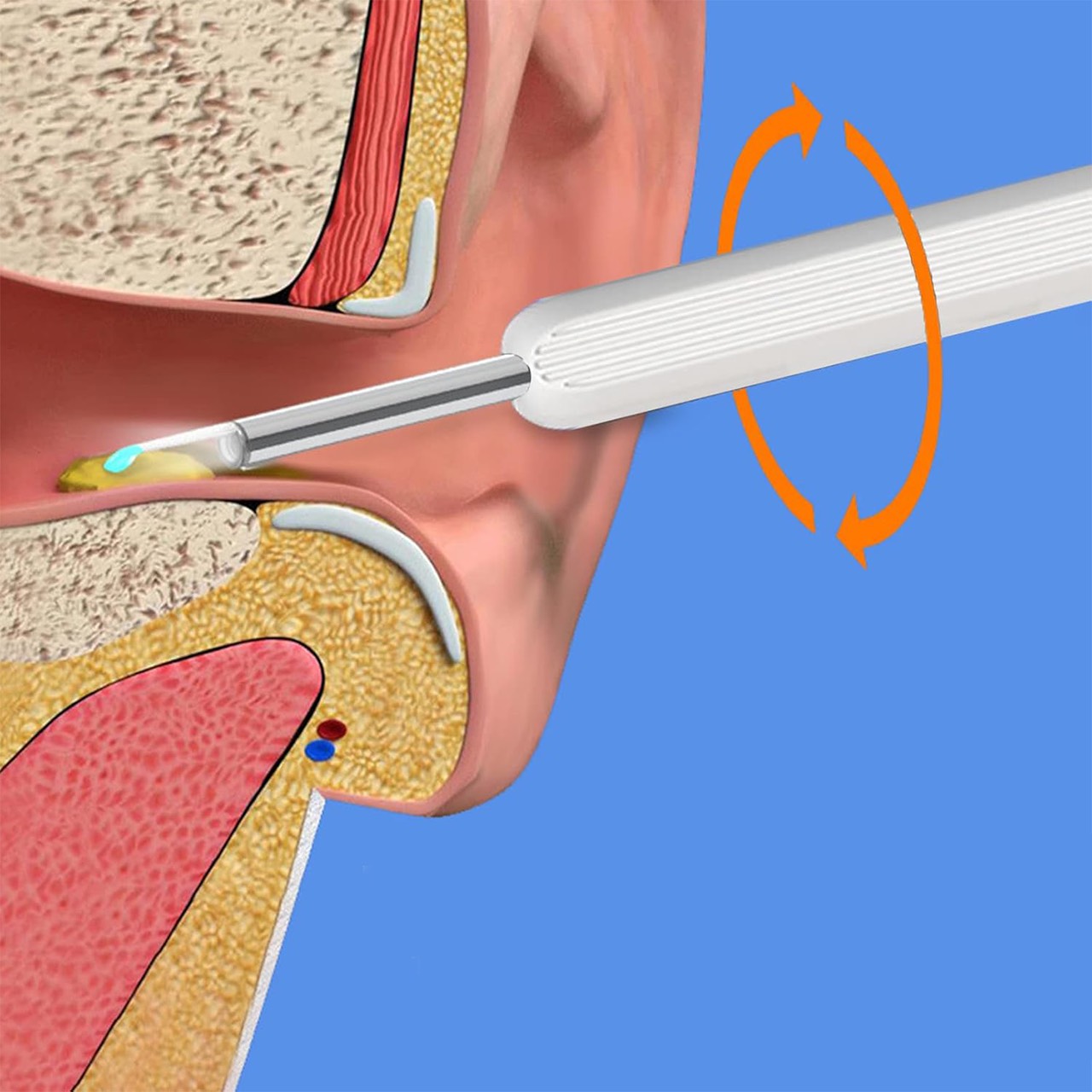 EarStick, l'aiuto per la pulizia del cerume con telecamera - Image 2