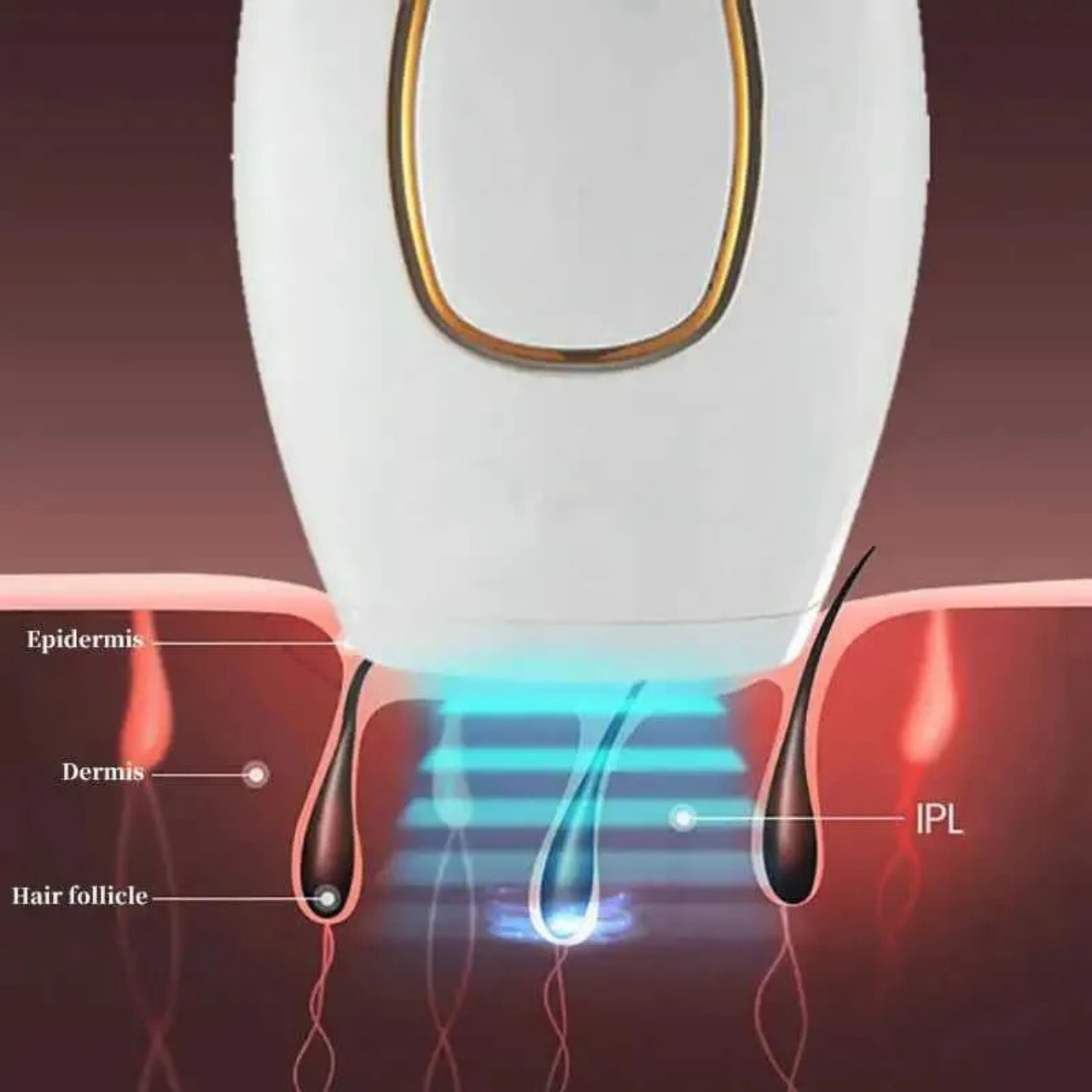 IPLStar, dispositivo di epilazione laser - Image 9