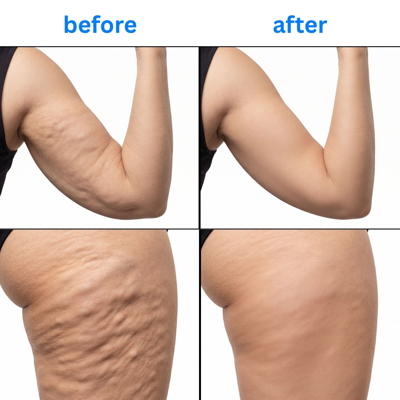 Per massaggio del corpo e riduzione della cellulite